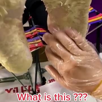 Extreme shedding of skin on feet. Very tempting.