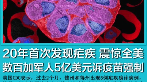 2023年6月28日 #新闻速7 音乐：#相思好比小蚂蚁