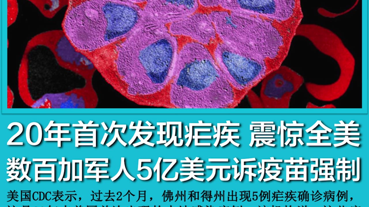 2023年6月28日 #新闻速7 音乐:#相思好比小蚂蚁