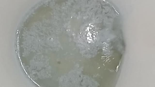 A whirlpool toilet