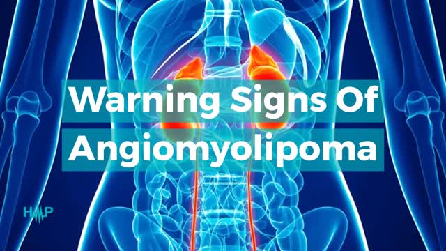 Warning Signs Of Angiomyolipoma