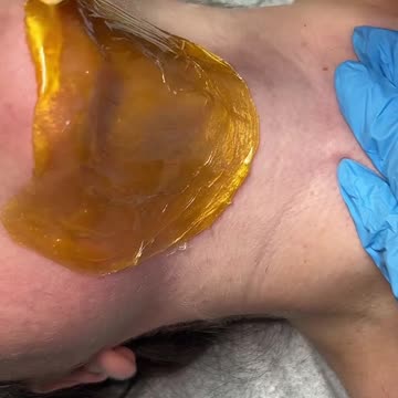 Facial Waxing with Golden Allure Hard Wax by Waxing Queen Adventures