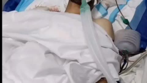 الصحفي احمد مطر داخل غرفه العناية ووضعه الصحي صعب