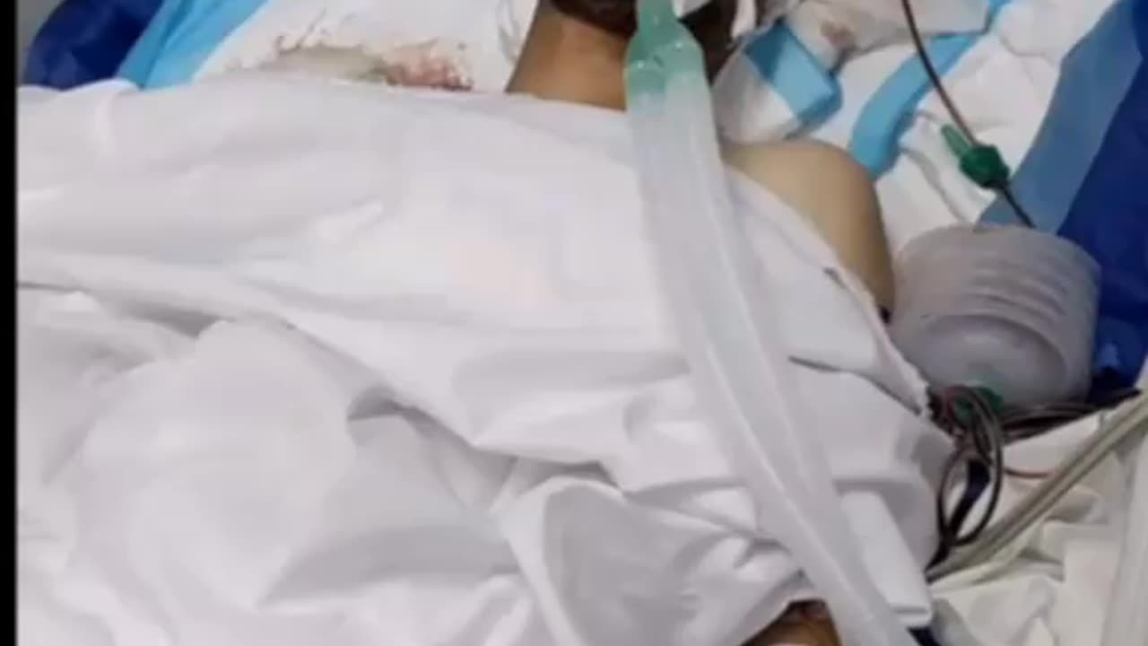 الصحفي احمد مطر داخل غرفه العناية ووضعه الصحي صعب