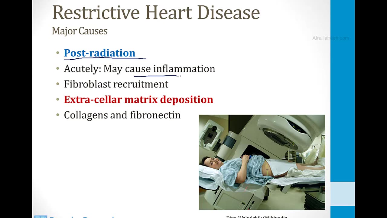 Cardiology - 6. Heart Failure - 3.Restrictive Cardiomyopathy