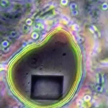 Cellular Biochip & Smart Dust or Biotechnology Found in Human Blood! Have YOU Been Biochipped?