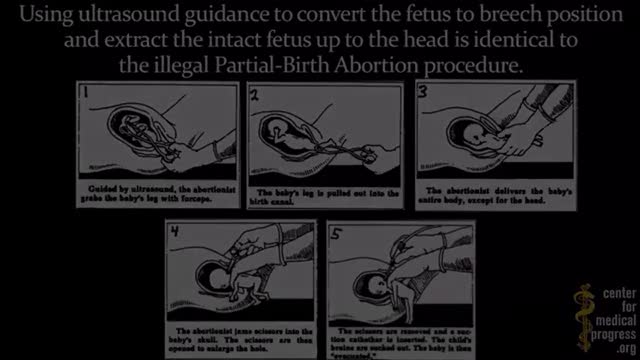 EPISODE 11 THE POPULATION CONTROL