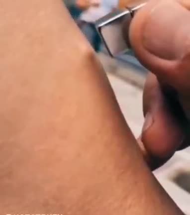 Russia 🇷🇺 Vax Graphene Test 💉☠