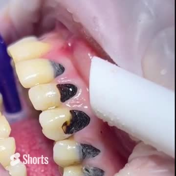 Limit your sugar intake