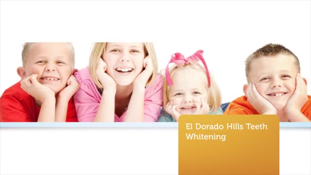 Dr. Michael B. Guess - Teeth Whitening in El Dorado Hills CA