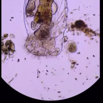 Your Rain Water Under the microscope 🔬