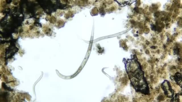 SALSICHA NO MICROSCÓPIO