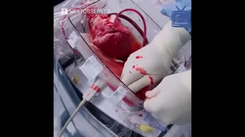 Human Heart Beating