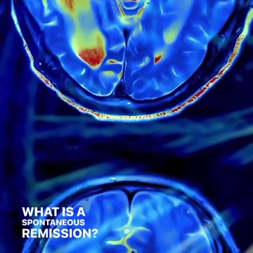 “Watch what you hold in your consciousness because it will translate into your physical expression…”