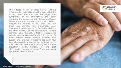 Some Unusual Symptoms Linked To Rheumatoid Arthritis