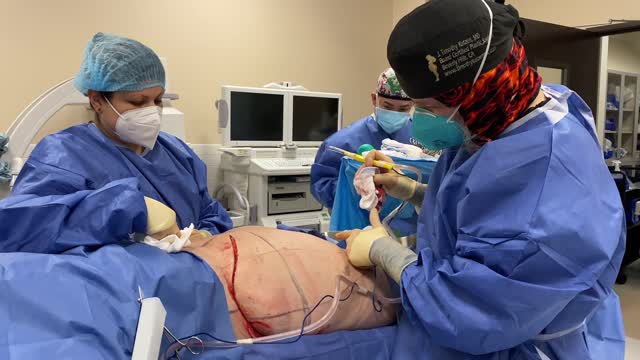 Posterior Body Lift after a Tummy Tuck and 200 lb Weight Loss