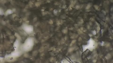 Canned chicken looks cool at 400x magnification!#microscope