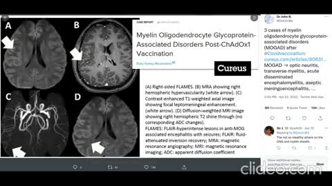 ⁣[VAX GENOCIDE] @DrJohnB2 on Twitter latest 4 posts