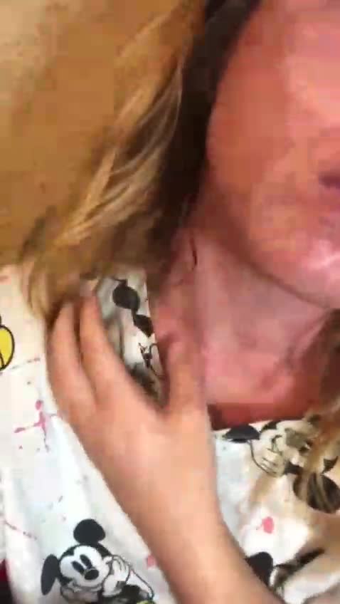 SERIOUS VACCINE ADVERSE SIDE EFFECTS. SEVERE DAMAGE TO LUNGS AS WELL.