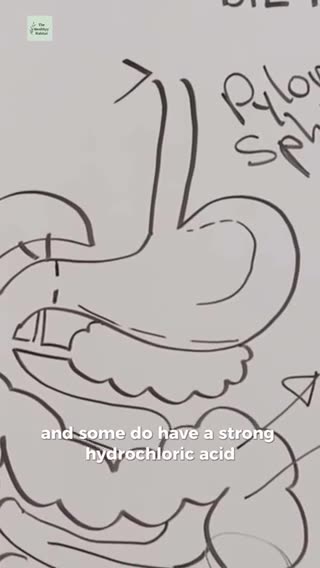 The problem with wheat.