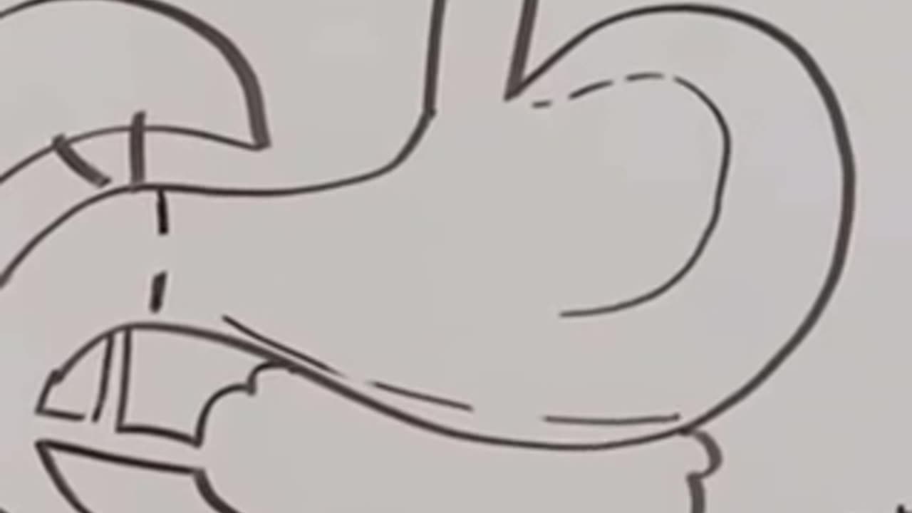 The problem with wheat.