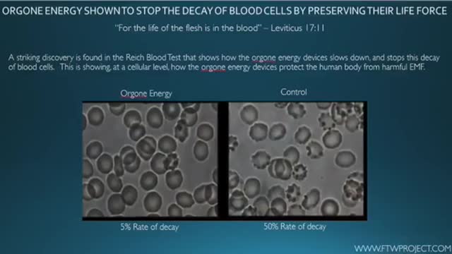 GRAPHENE OXIDE, 5G & COVID (FTW PRESENTS)