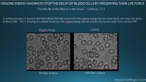 GRAPHENE OXIDE, 5G & COVID (FTW PRESENTS)