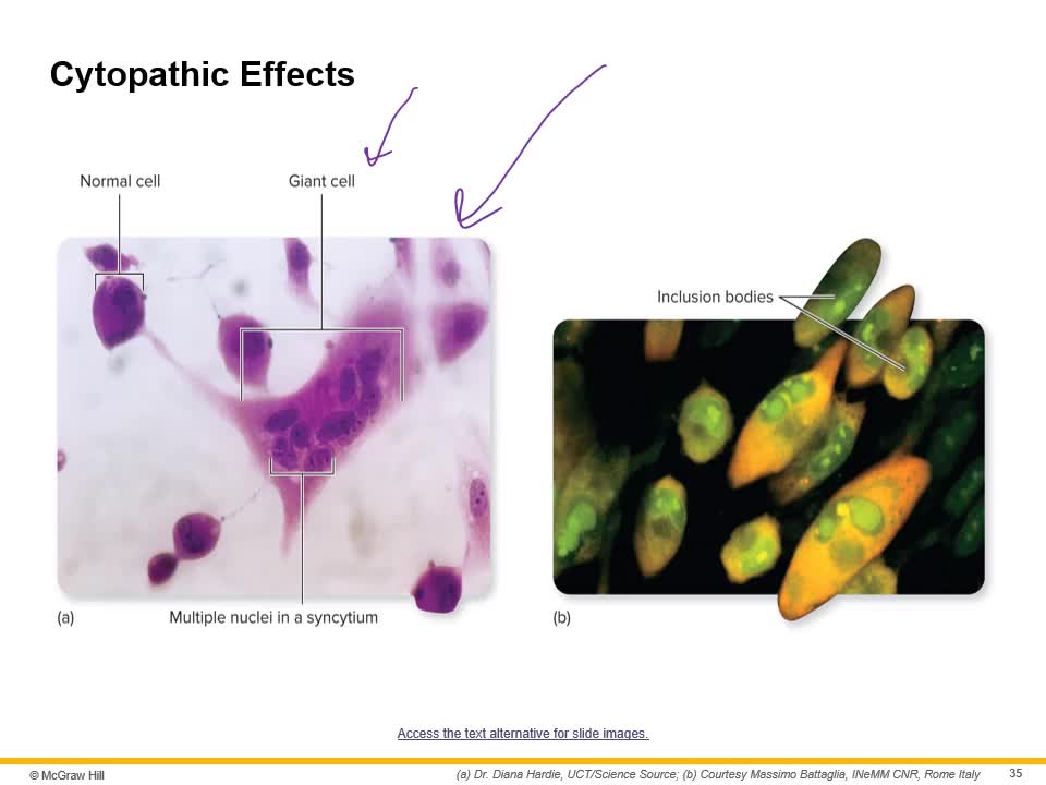 Microbiology - Viruses