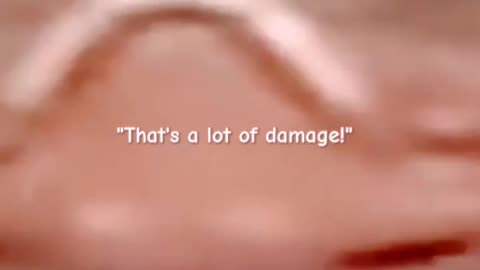 WHEN THAT'S A LOT OF DAMAGE