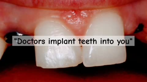 RABBIT HOLES & TOBACCO BOWLS: TEETH IMPLANTS AT BIRTH