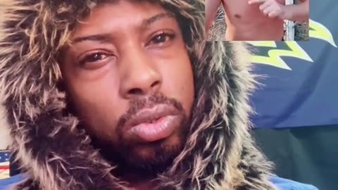 How is this guy able to be out in public?