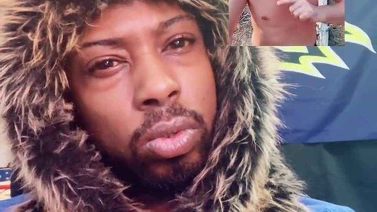 How is this guy able to be out in public?