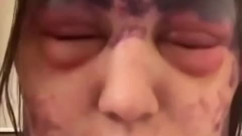 💉⚠️ALEXIS LORENZE, DE 23 ANOS, MAIS UMA VÍTIMA DO 'CIENTISMO' DAS VACINAS💉⚠️