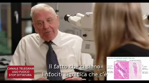 PUNTURINA ASSASSINA - Prof Burkhardt: "La Vasculite è un'infiammazione che colpisce i capillari del cervello a causa della Spike"