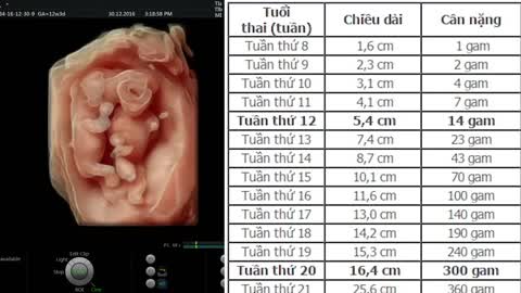 BẢNG TIÊU CHUẨN CHIỀU CAO VÀ CÂN NẶNG THAI NHI THEO TỪNG TUẦN TUỔI