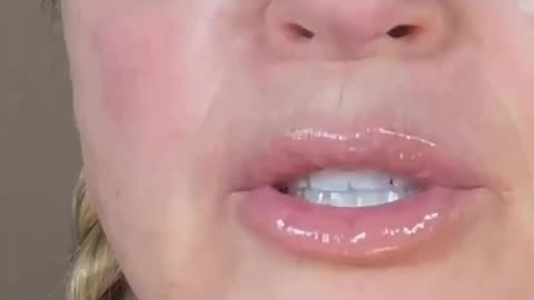 MY FAVORITE UNDER EYE TREATMENT - Juve Eyes