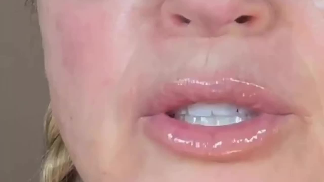 MY FAVORITE UNDER EYE TREATMENT - Juve Eyes