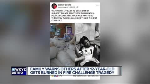 12-Year-Old Almost Kills Herself With "Fire Challenge"