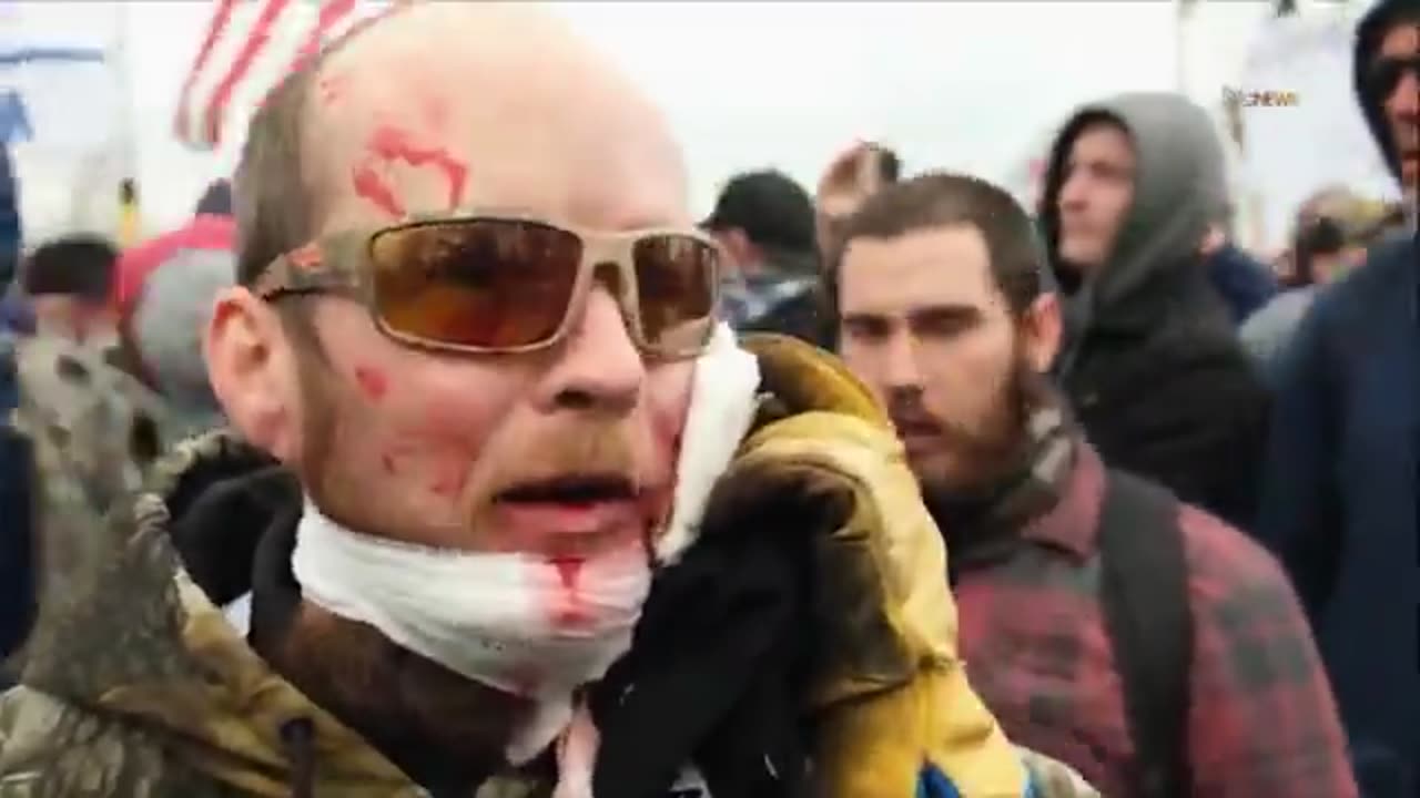 #NeverForget When Feds Shot Americans In the Face For Being American