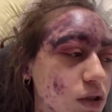 Alexis was mandated to take three vaccines against her will (STORY/LINK IN DESCRIPTION)