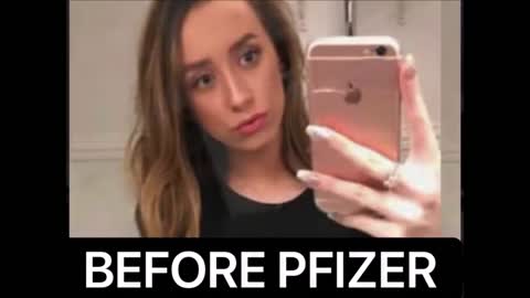 BREAKING : 20 Yr Old Eve Dale Before & After Pfizer Franknshot !! TNTV