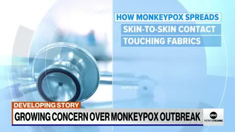 3 states in US declares states emergency amid monkeypox outbreak