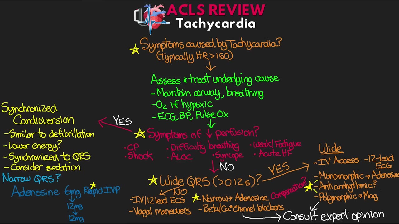 Tachycardia Algorhythms