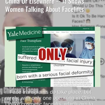 Fact Check: Video Does NOT Prove 'Harvesting Children's Faces' In China -- Shows Facelifts