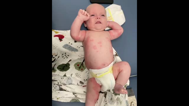 Alyssa Mossman Darrow - Moderna WARNING about Breastfeeding