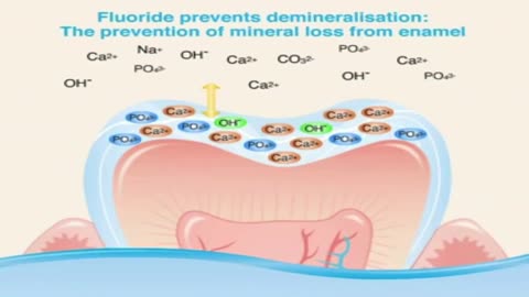 FLUORIDE MAKES YOUR BODY ABSORB EXTRA ALUMINUM; AND WHERE DOES THE ALUMINUM GO