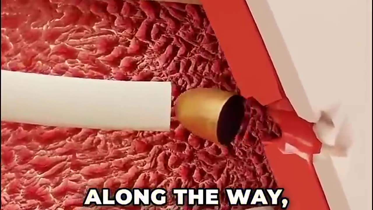 What Would Happen If You Got Shot?