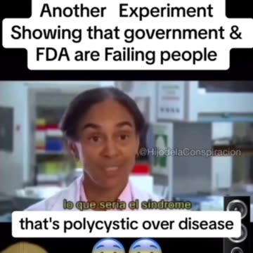 How the American diet damage your brain.