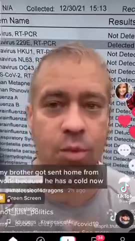 Coronavirus 229E is the Common Cold