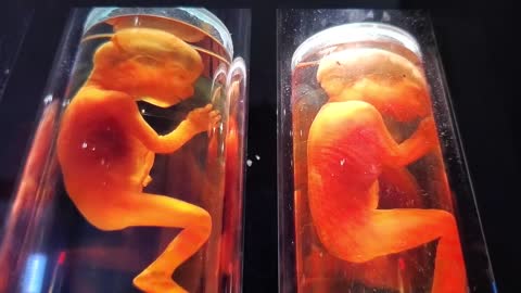Aborted babies DNA in the Vaccines? Del Bigtree